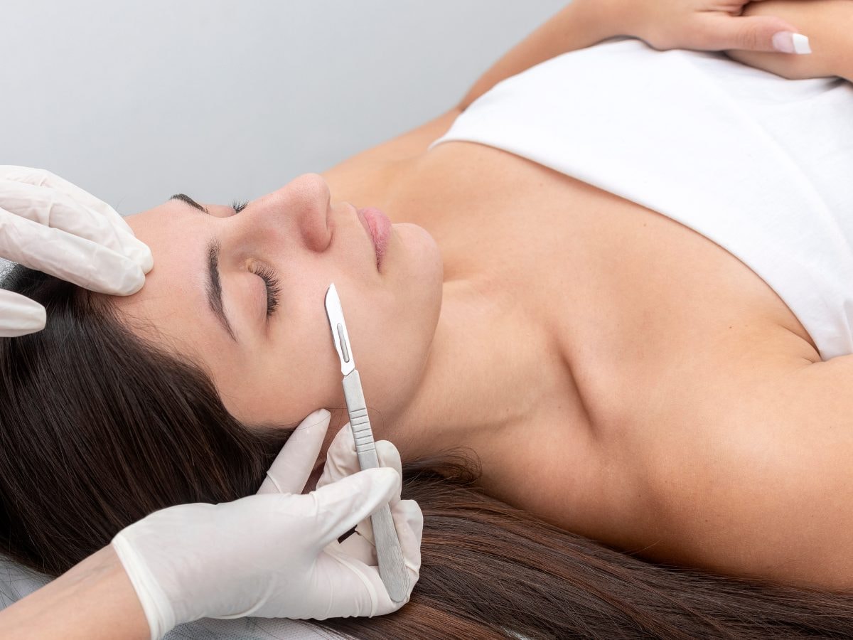 Tratamiento de dermaplaning en el rostro