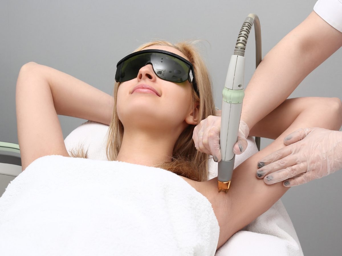 Laser hair removal on the underarm